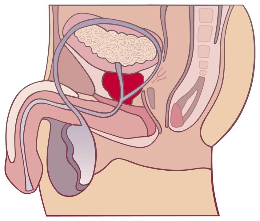 Tudo sobre prostatite