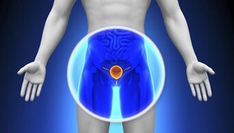 Tratamento de prostatite com drogas
