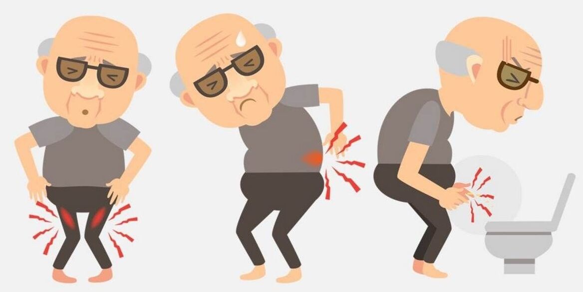 sintomas de prostatite