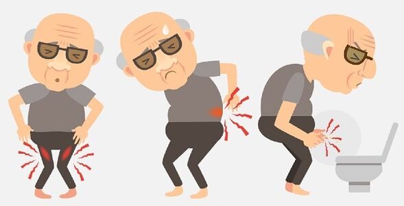 sintomas de prostatite e seu tratamento com medicamentos